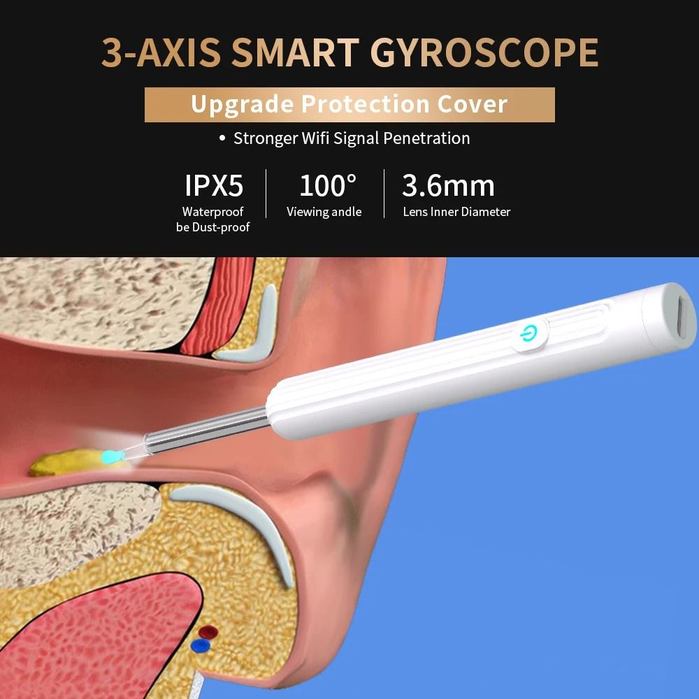 1296P Ultra-HD Smart Visual Ear Cleaner with WiFi Camera