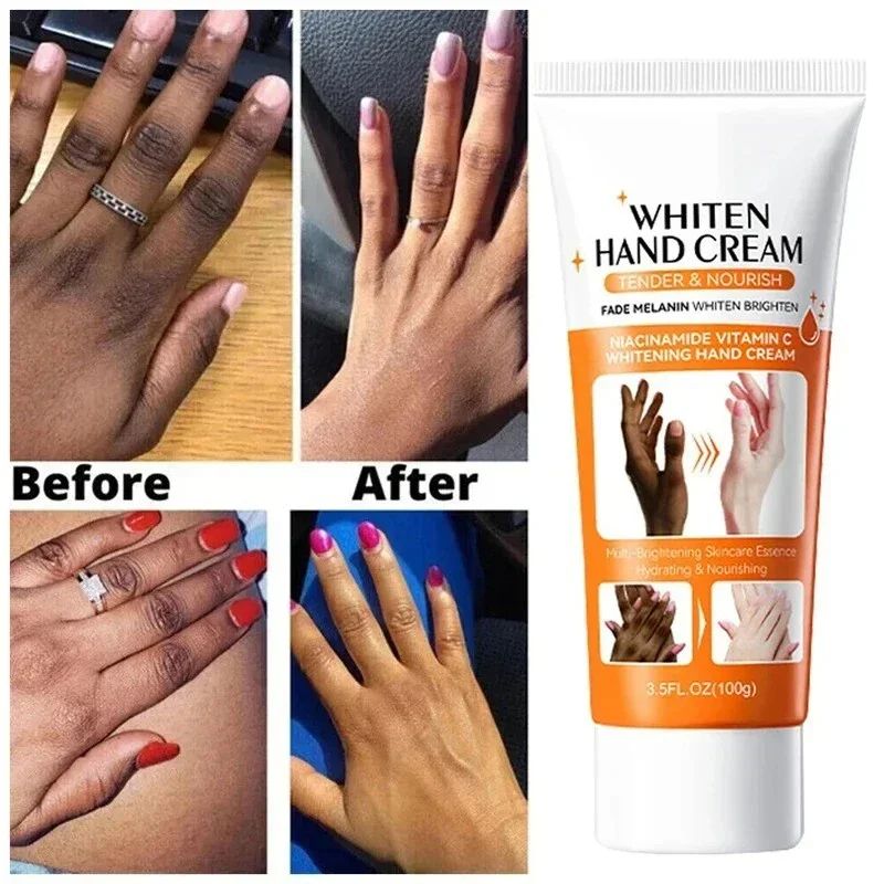 Dark Knuckles Brightening Serum, Hand Anti Cracking Cream, Moisturizer for Dark Skin Stains Remover and Finger Repair