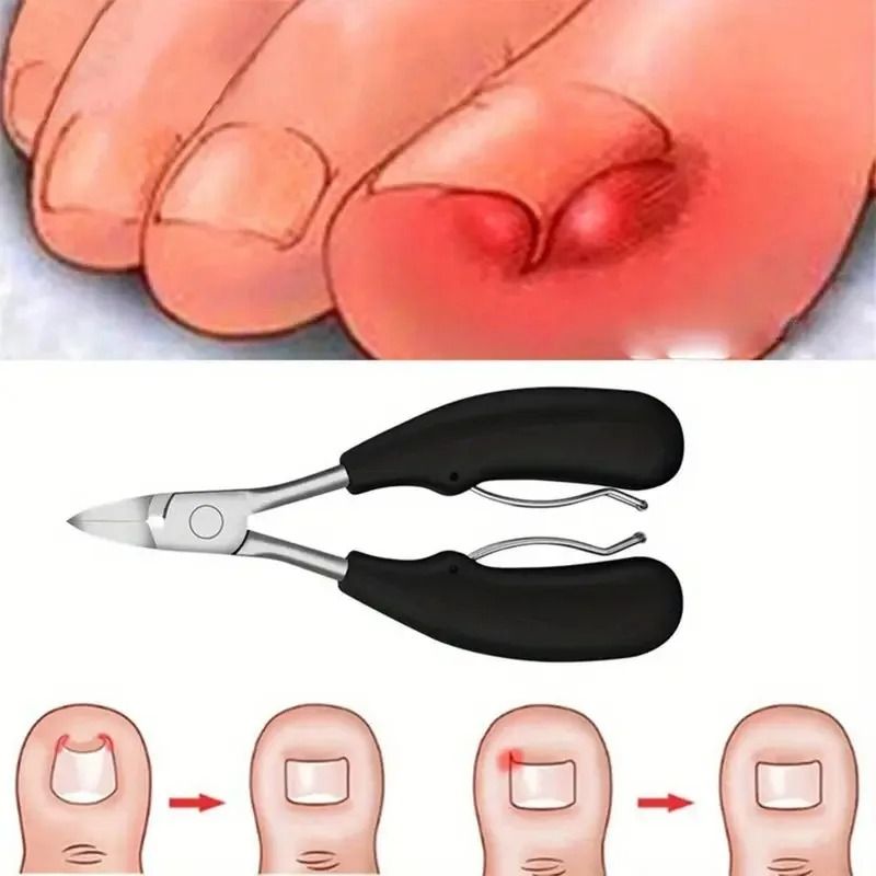 Professional Ingrown Toenail Clipper Set with Stainless Steel Tools