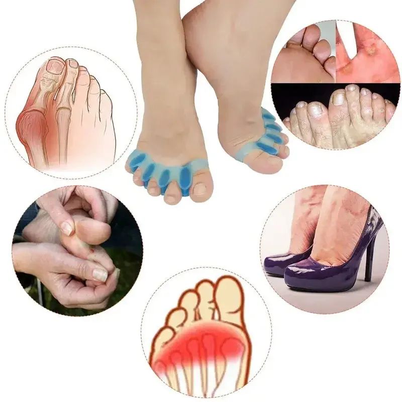 1-Pair Gel Toe Separator & Bunion Corrector – Soft Silicone Toe Spacers & Hammer Toe Straightener