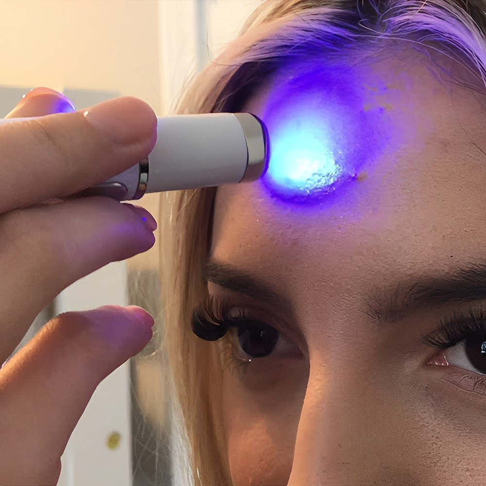 Anti Fungus Laser Pen