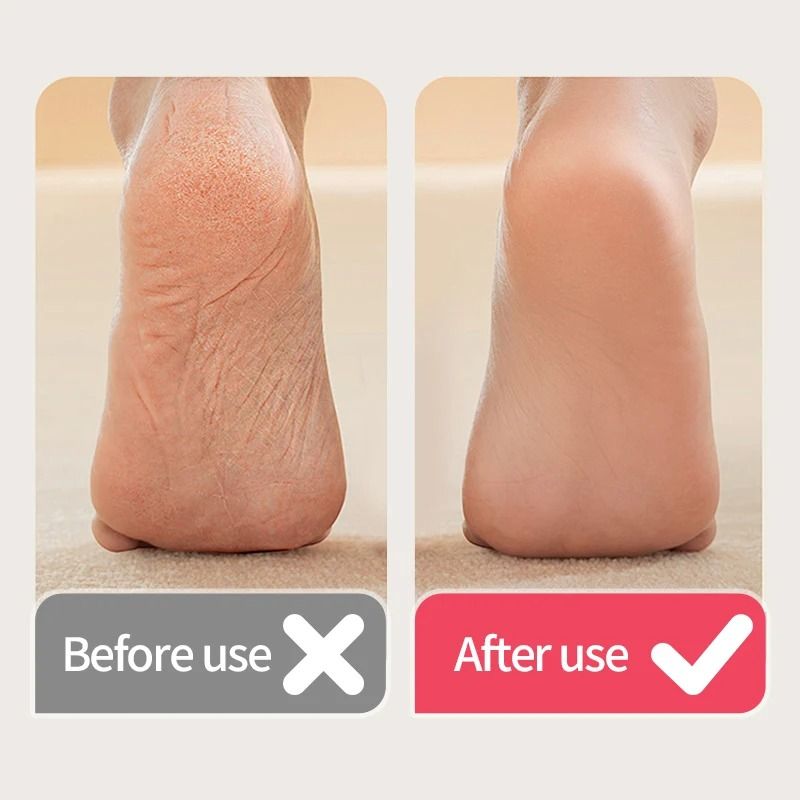 USB Powered Rechargeable Electric Foot Grinder and Callus Remover