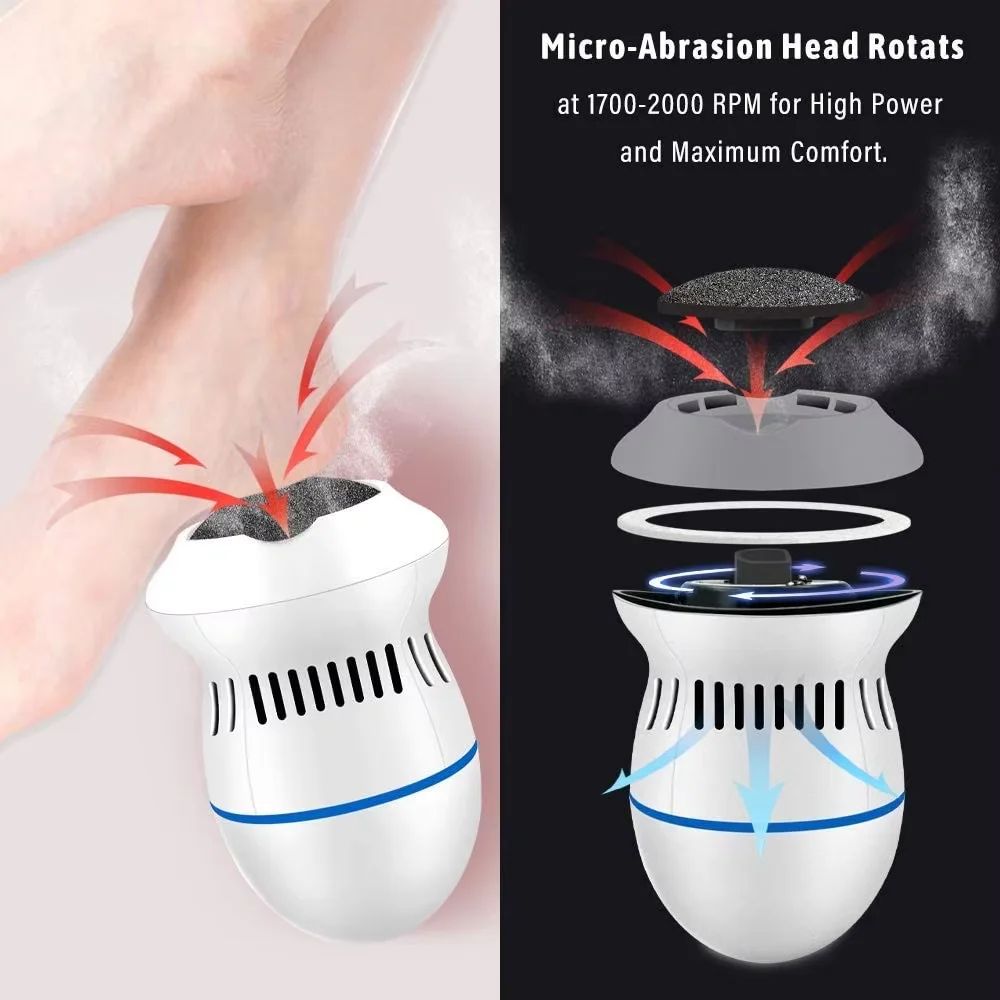 Rechargeable Electric Foot Grinder Callus Remover – Pedicure Foot File Exfoliator for Hard Skin, Dry Feet & Smooth Heels