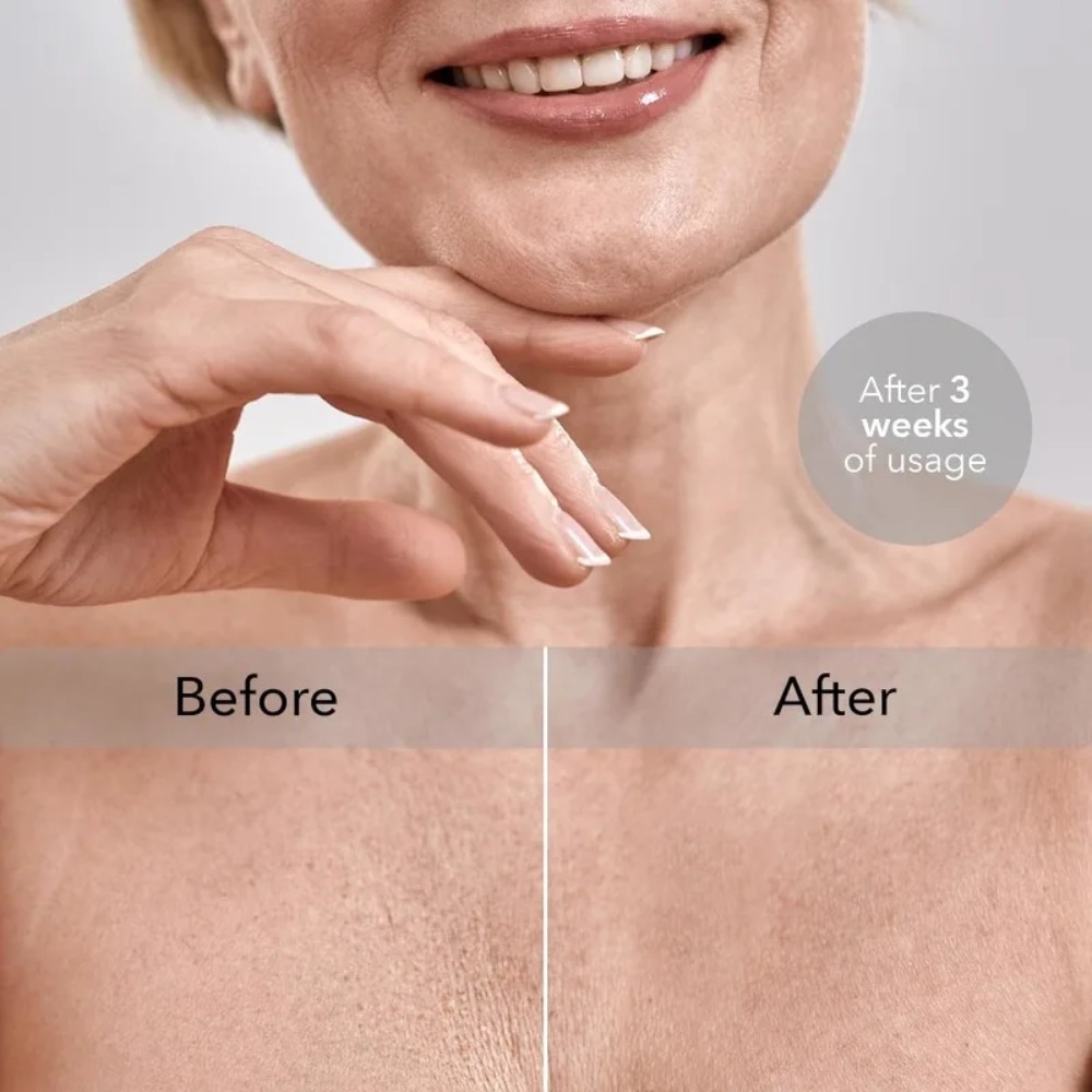 Silicone Anti Wrinkle Chest Pads Overnight Breast Wrinkle Pads Reusable Skin Tightening