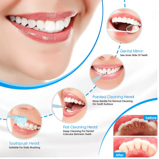 Electric Dental Calculus Remover – Teeth Cleaning & Whitening Scaler Device