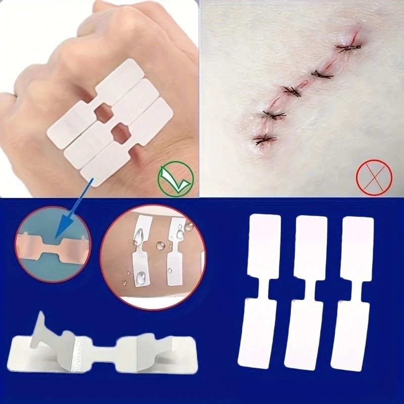 5-Piece Outdoor Quick Suture Patch and Emergency Wound Adhesive Tape Kit