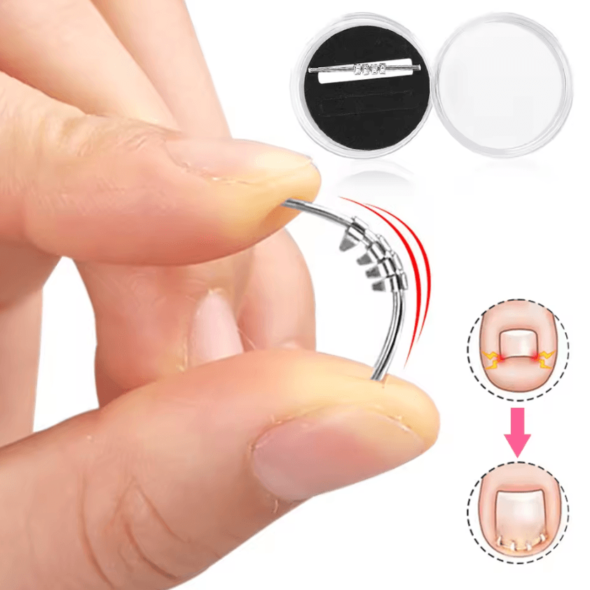 Professional Ingrown Toenail Corrector Tool Curved Clamp Pedicure Nail Straightening Kit