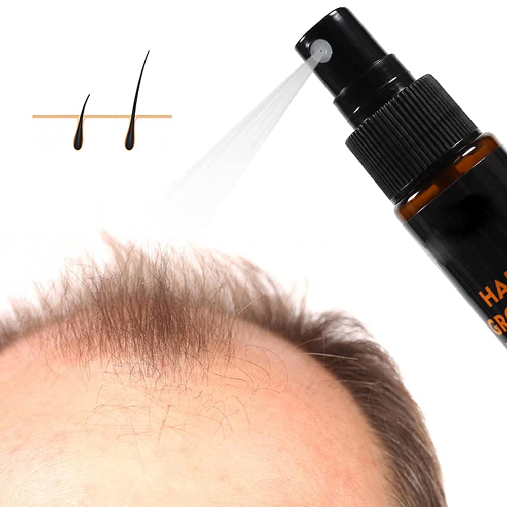 Hair Re-Growth Herbal Essence Spray