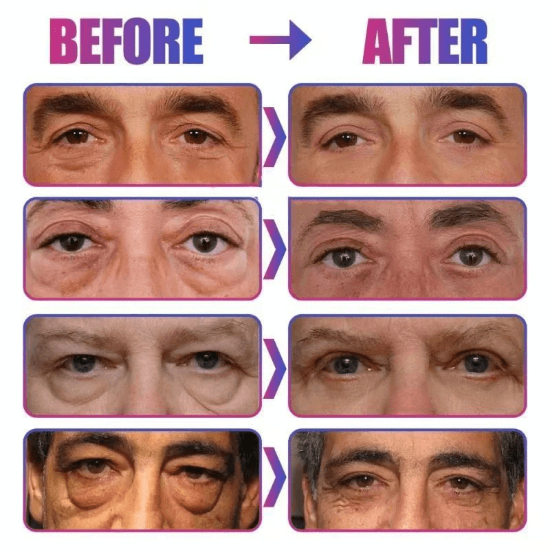 Instant Eye Bag Removal Cream, Reduce Puffiness & Dark Circles, Firm & Brighten