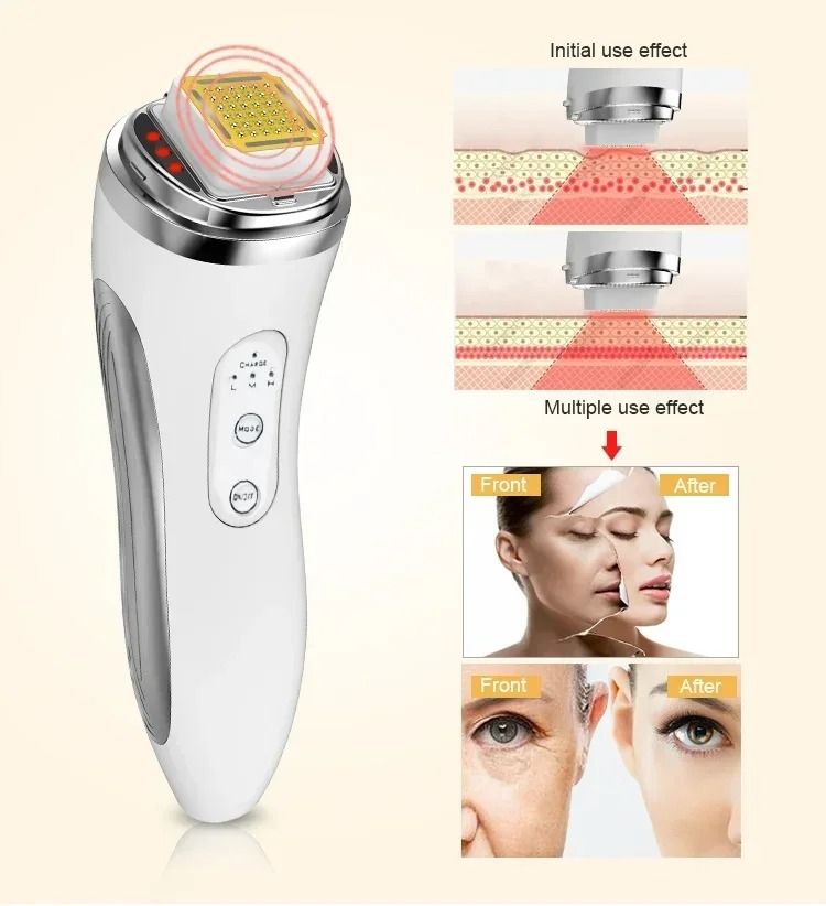 RF Radio Frequency Face Lifting Device Skin Tightening Beauty Massager