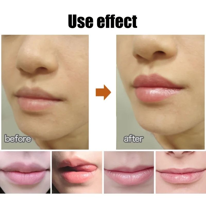 Cute Ball Lip Balm Hydrating Lip Balm Moisturizing Lip Care