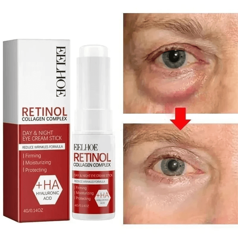 Korean Eye Cream for Dark Circles, Puffiness, Fine Lines & Under-Eye Wrinkles