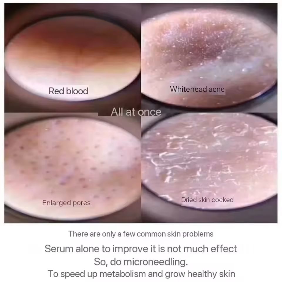 Sponge Microcrystal Freeze-Dried Powder Collagen Booster Skin Renewal Treatment