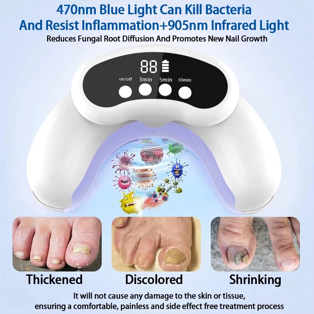 Portable Laser Nail Fungus Treatment Device for Onychomycosis and Ingrown Toenails