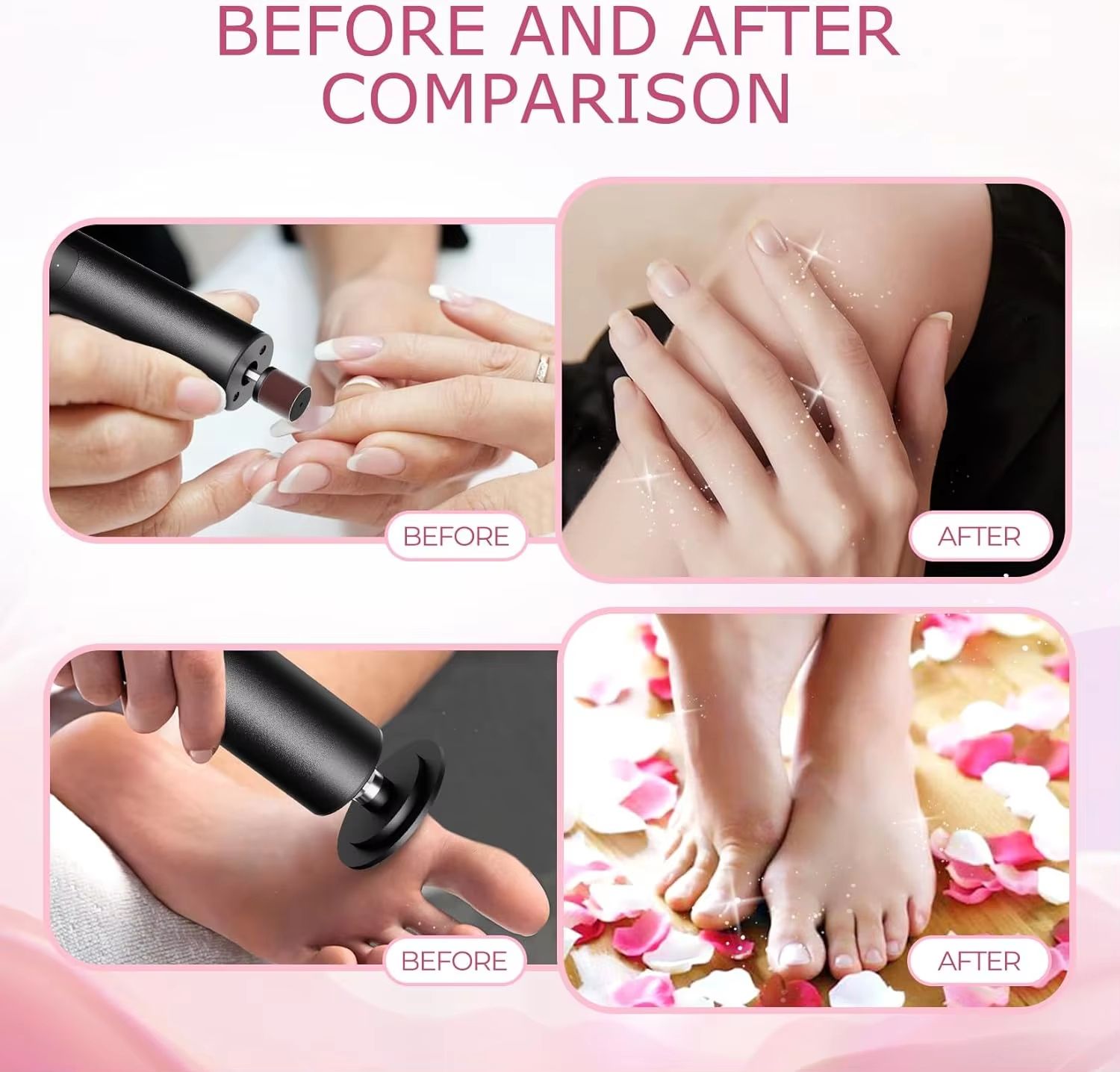 2-in-1 Electric Foot Callus Remover & Nail Grinder with 6 Speeds and Sandpaper Foot Sander Tool