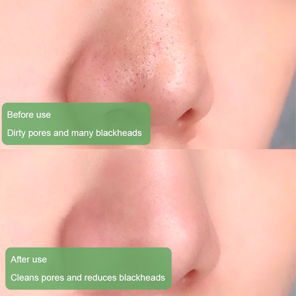 Deep Cleansing And Blackhead Remover Facial Stick | Green Tea Eggplant Purifying Clay | Cleansing Stick Mask