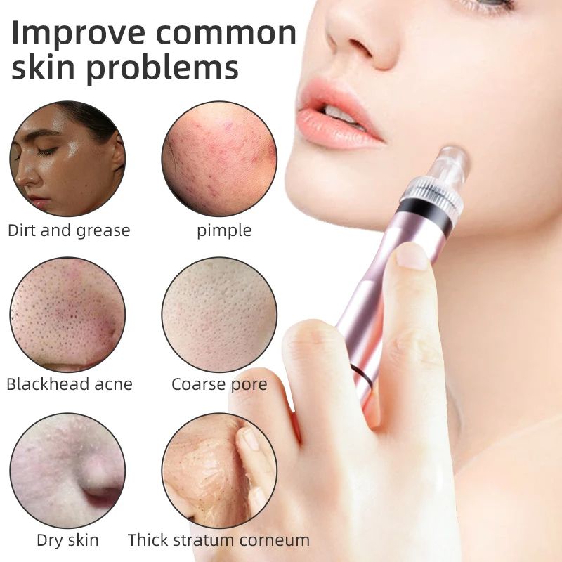 Small Bubble Cleansing Machine, Blackhead Removal & Pore Vacuum Suction for Acne Treatment