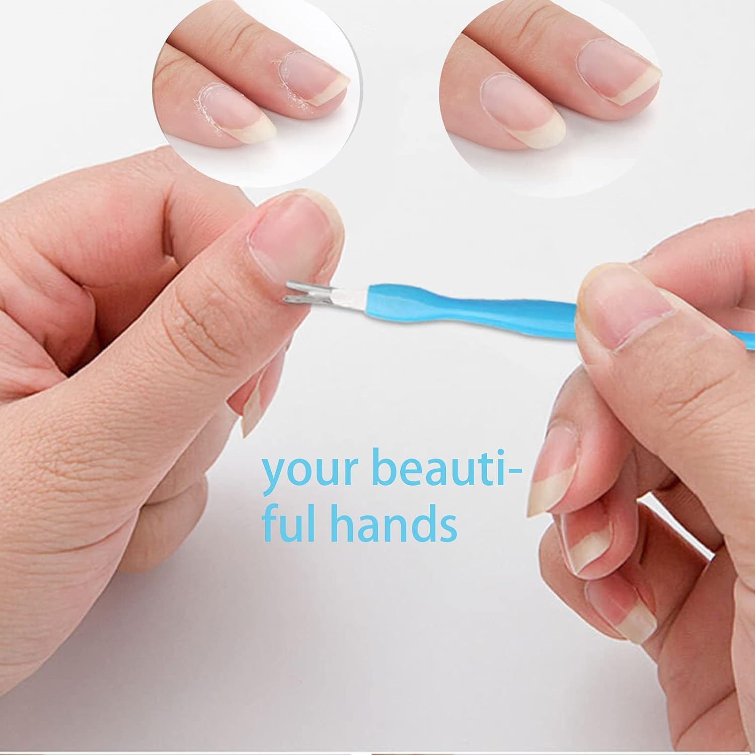 Exfoliating Foot Octopus Fish Eye, Heel Sharpener, Heel Cracking Files, Heel Cramping Treatment, Remove Cracked Heels