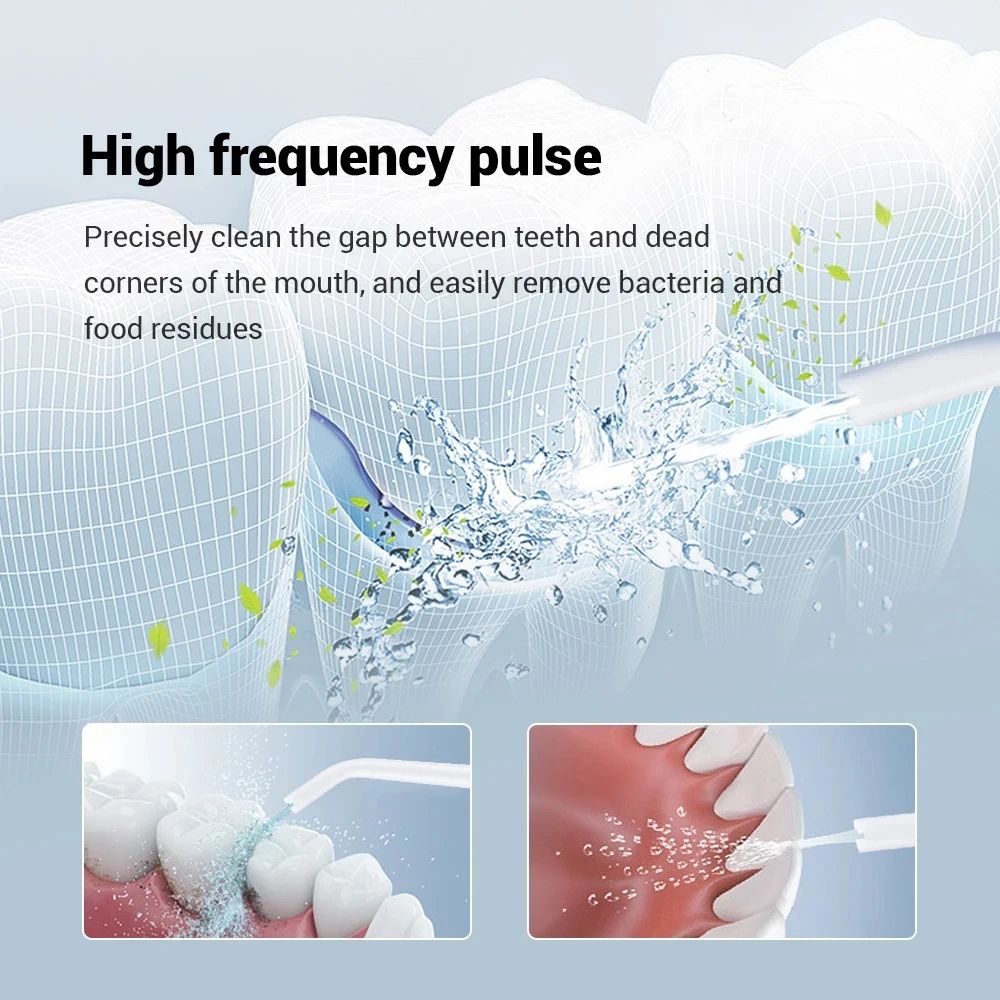 YOUPIN Water Flosser, USB Rechargeable Electric Oral Irrigator for Dental Whitening, Jet Tooth Scaler & Gum Care