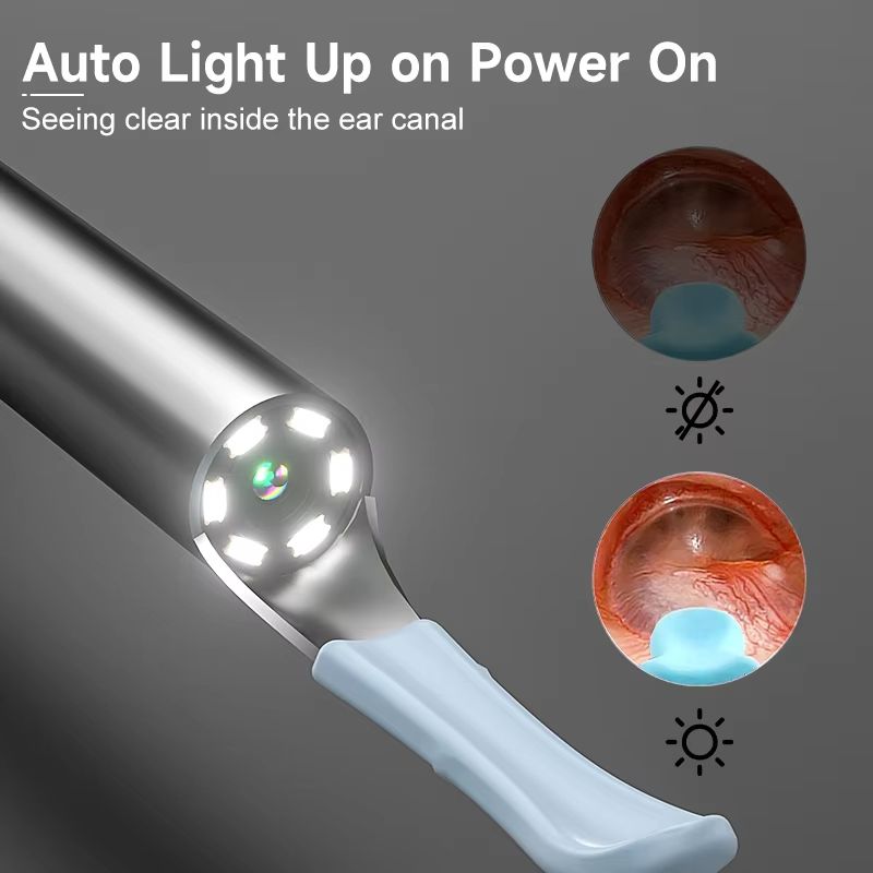 Smart Visual Ear Cleaner with HD 1080P Camera and WiFi Connectivity