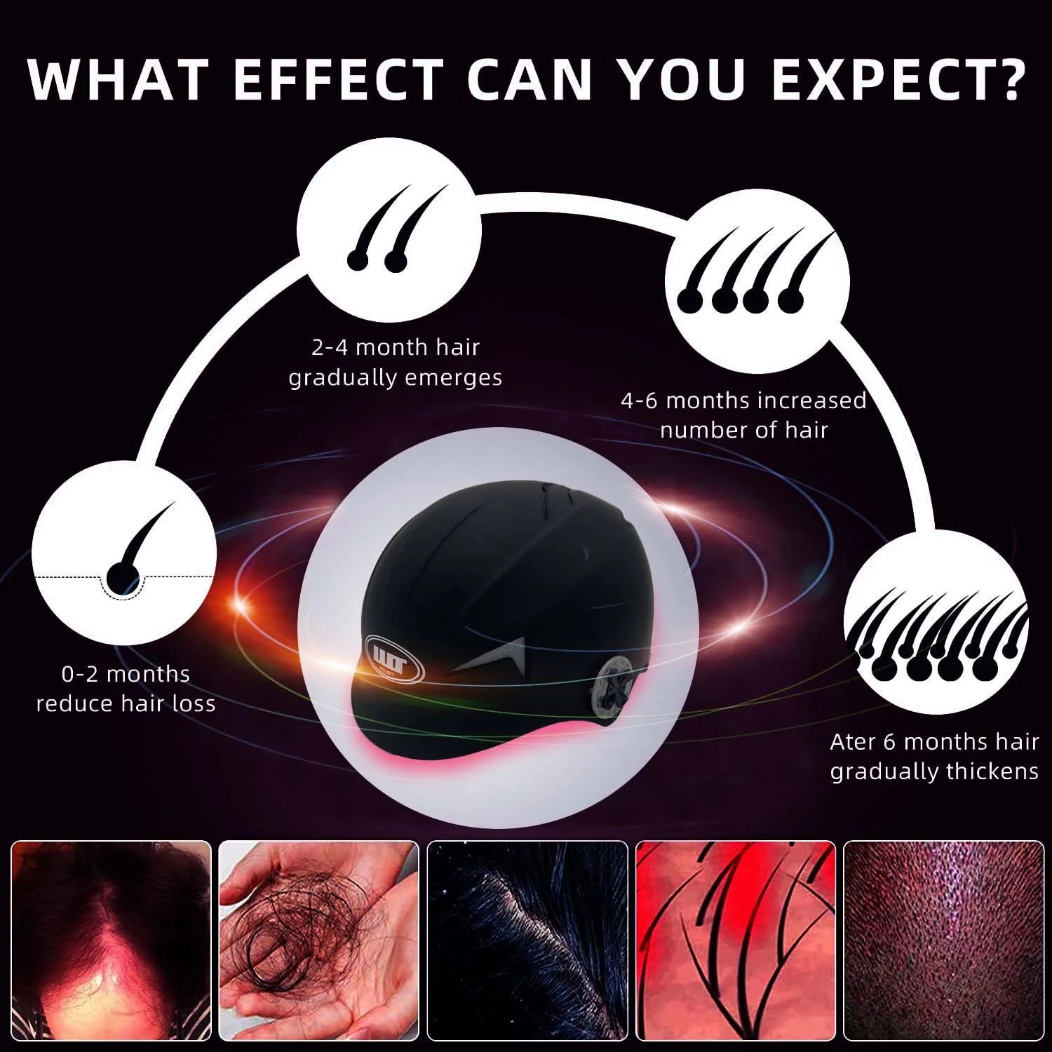 Premium 650nm Low-Level Laser Hair Growth Device - At-Home LLLT Hair Regrowth Therapy