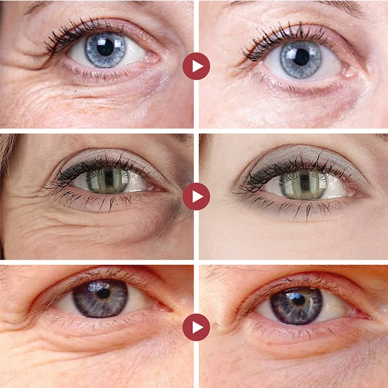 Retinol Eye Cream Stick