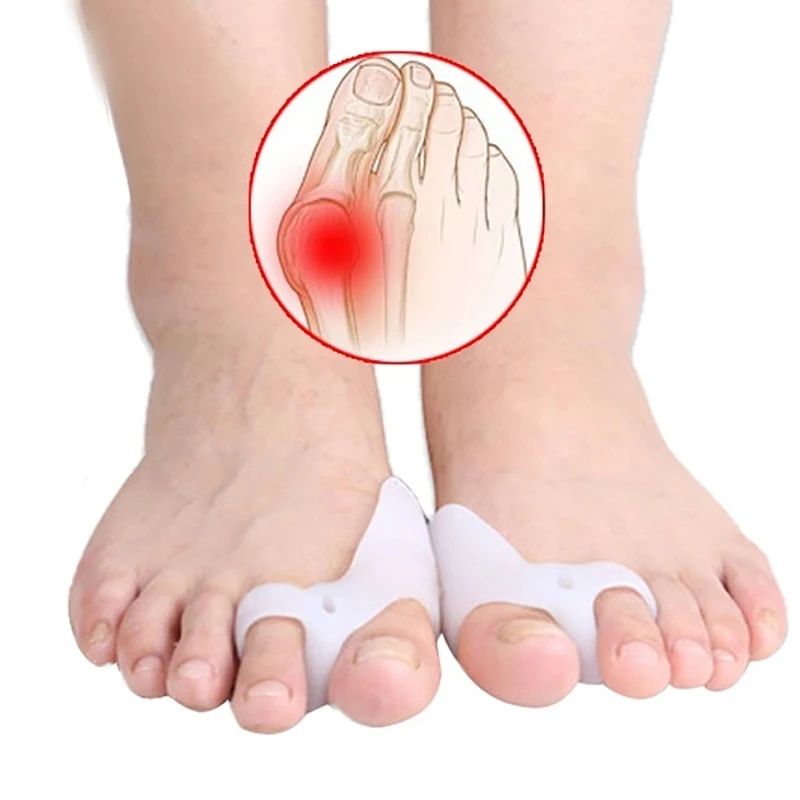 AlignEase Silicone Toe Corrector & Hallux Valgus Separator (1 Pair)