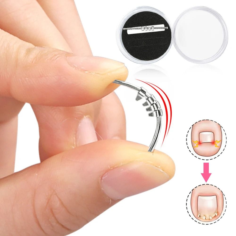 Ingrown Toenail Corrector – Precision Leverage Pedicure Tool for Curvature Correction