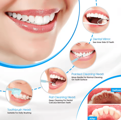 BrightClean Pro Electric Dental Calculus Remover & Teeth Care Device