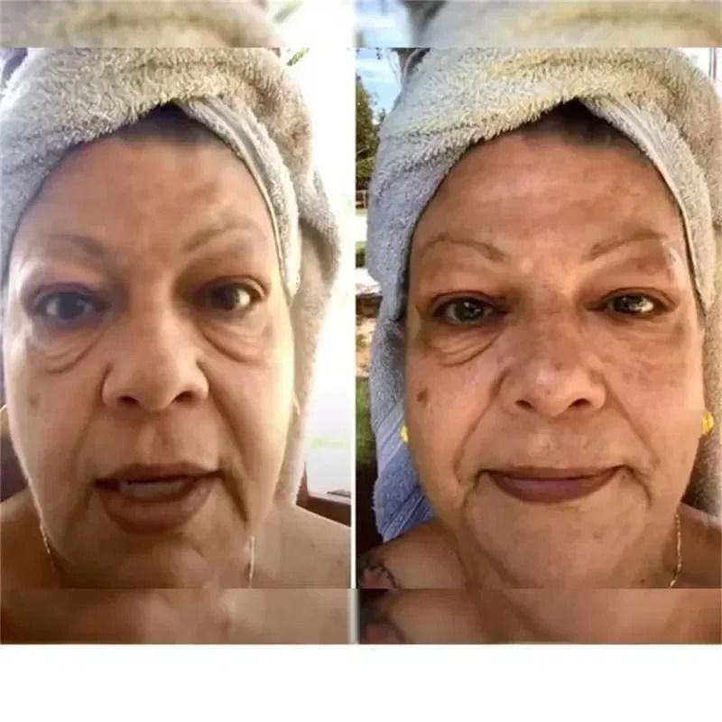 Instant Eye Bag Removal Cream – Collagen Infused Anti-Wrinkle & Firming Therapy