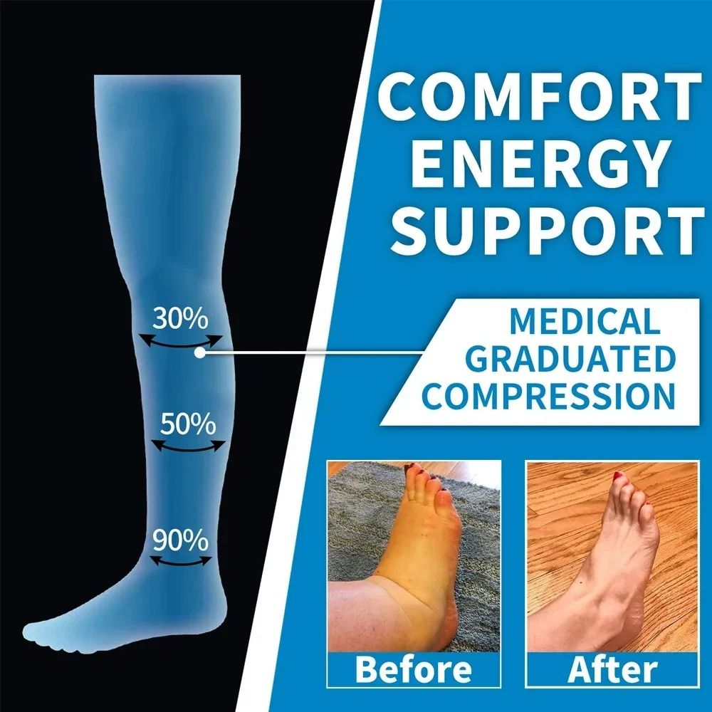 Gradient Pressure Knee High Compression Stockings (Pair)