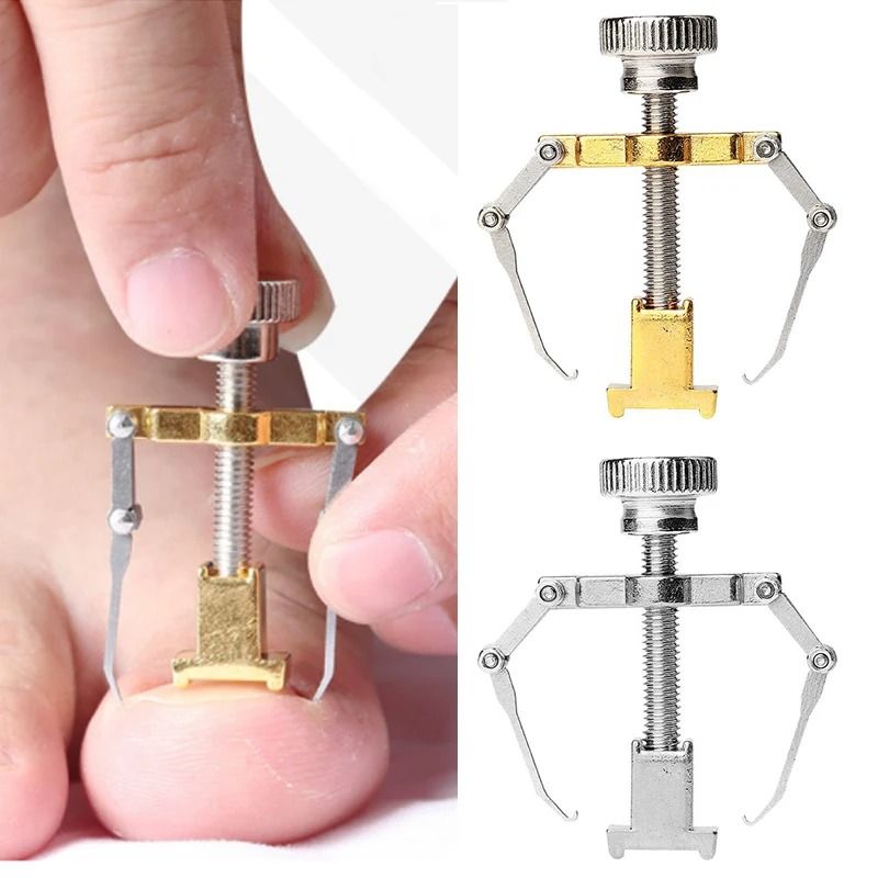 Stainless Steel Ingrown Toenail Corrector – Professional Paronychia Relief Tool