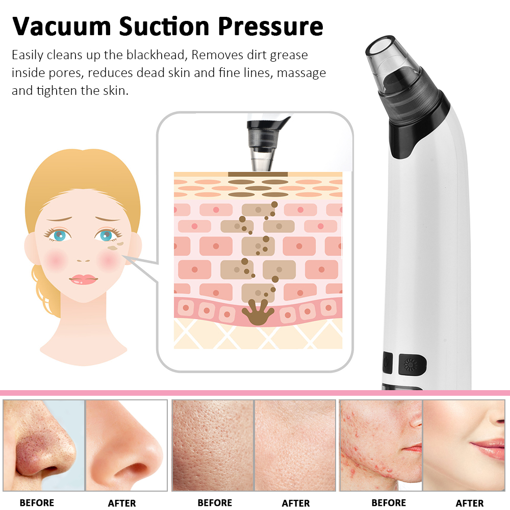 Facial Cleaner Black Point Vacuum Suction, Beauty Blackhead Remover, Black Head Dots Extractor Skin Care Tool