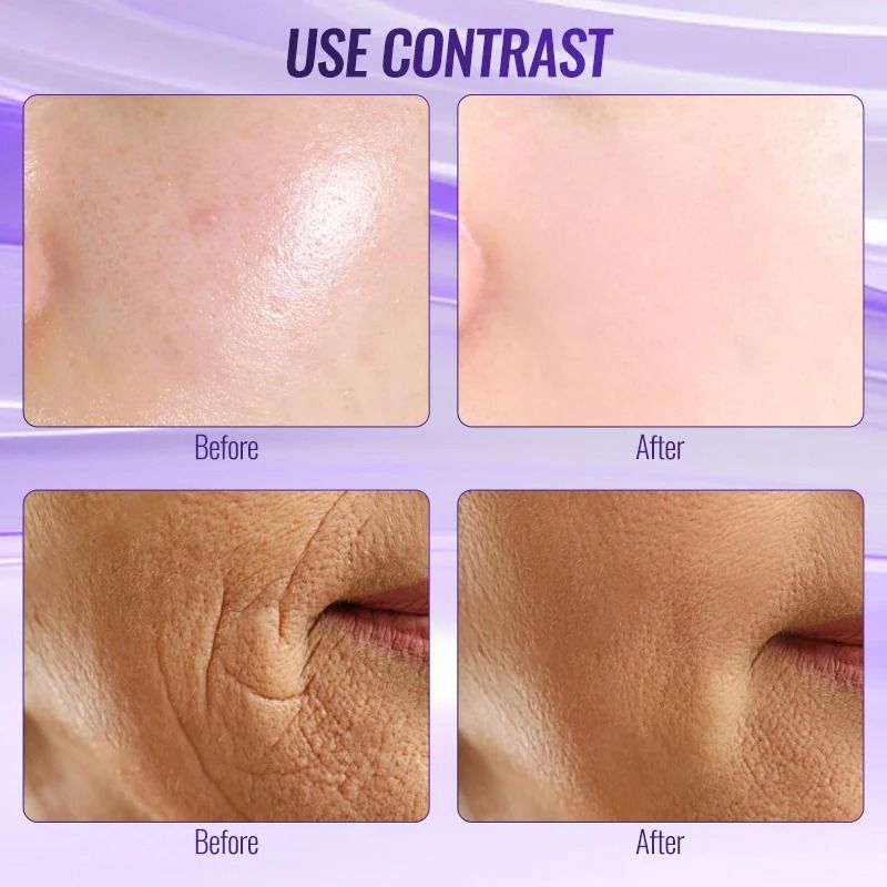 6 in 1 High Frequency Wand Professional Home Spa Device for Acne and Skin Firming