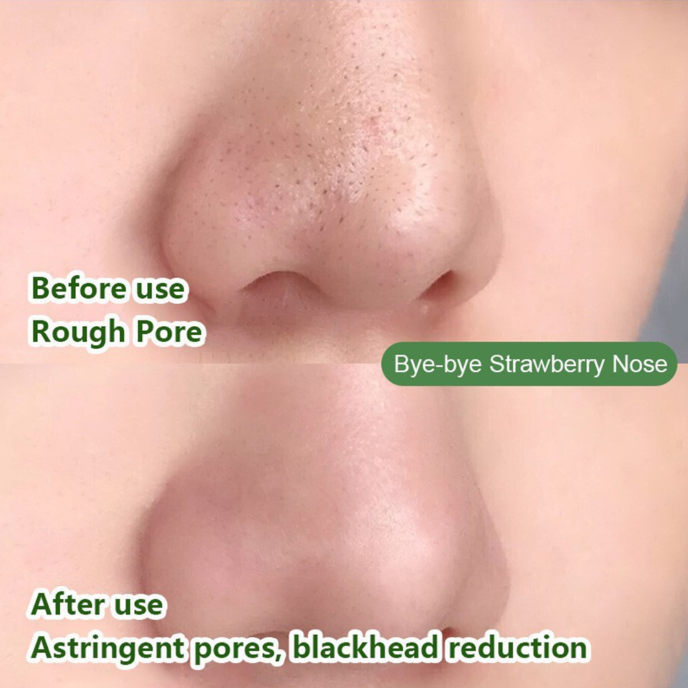 Skin Purifying Black Head Remover Mask