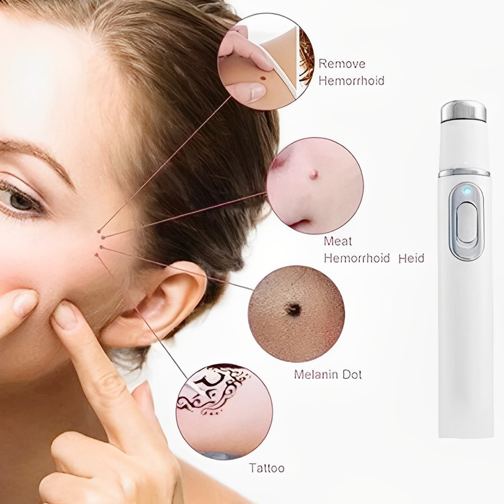 Advanced Technology Anti-Fungal Laser Pen | Home Treatment Fungus Removal Pen | Fungus Cleaning Pen Blue Light Therapy