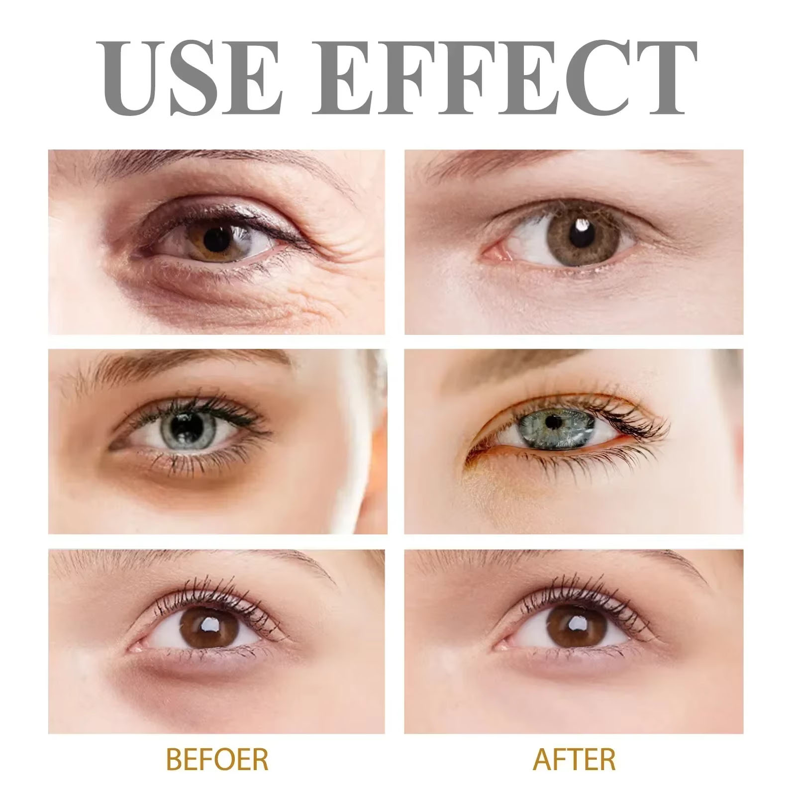 Eye Cream Removes Dark Circles, Tightens The Eyes Lifting Firming, Eye Bags Remover, Hydrating Anti Wrinkle Eye Cream