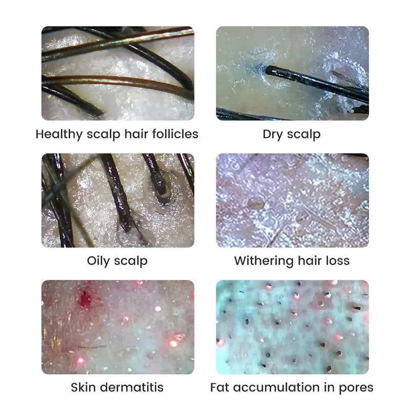 Wireless Digital Skin and Scalp Analyzer with WiFi Connection and High Precision Facial Magnifier Microscope