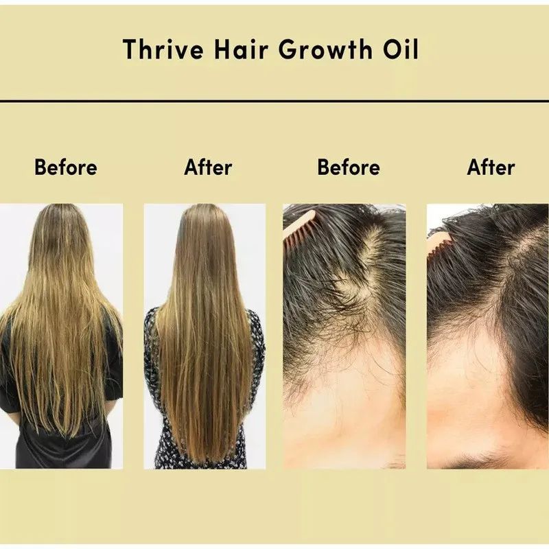 Ultimate Moisture Anti-Frizz Hair Oil – Deep Repair Hair Care Elixir