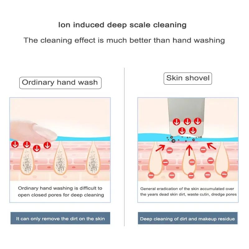 Ultrasonic Skin Scrubber Facial Spatula Blackhead Remover with Ion Cleansing Modes