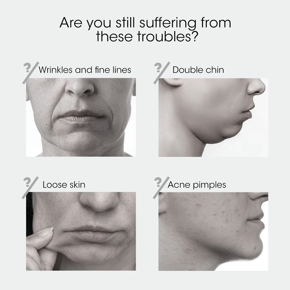 Face Lifting Device Red Light Skin Rejuvenation V Face Massager Double Chin Lift Up Remote Control