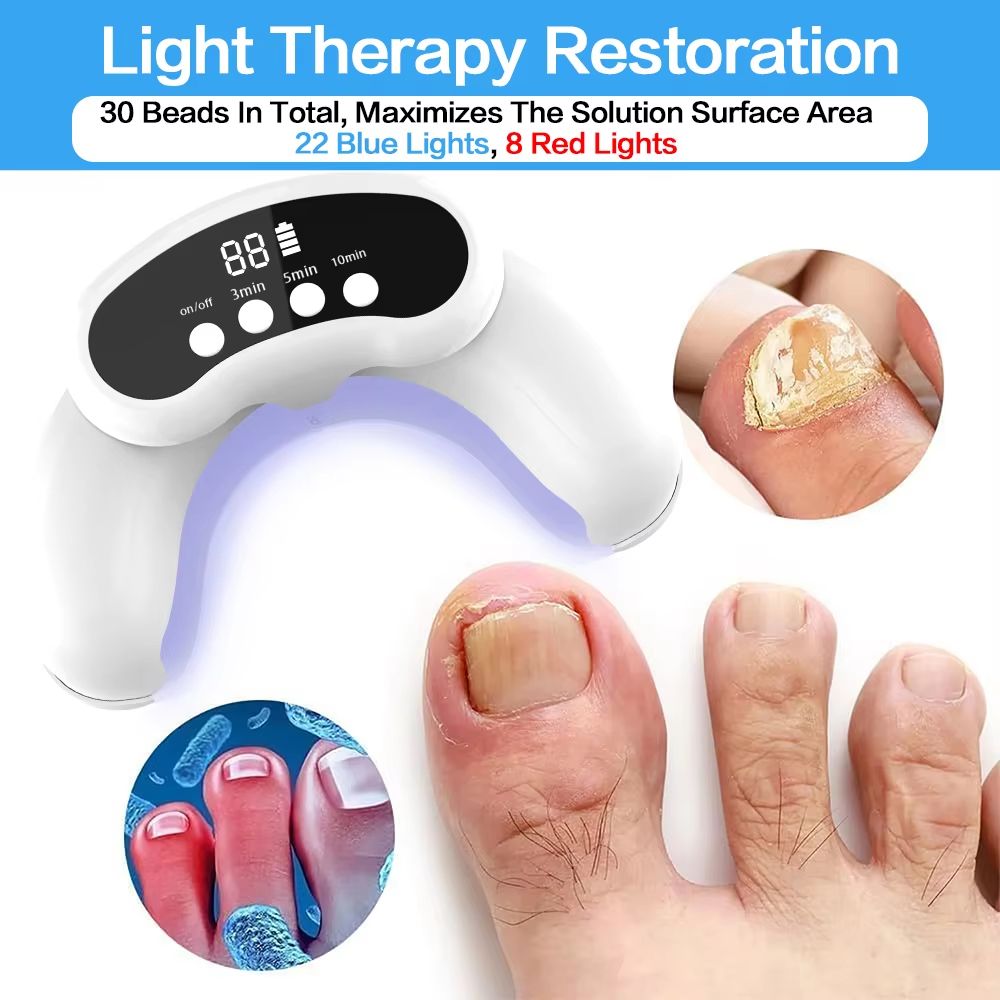 Portable Laser Nail Fungus Treatment Device for Onychomycosis and Ingrown Toenails