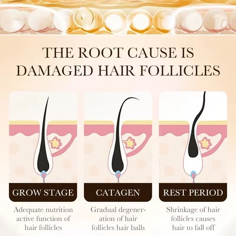 Vita Thick Biotin-Boost Hair Growth Oil – Intensive Scalp & Hair Loss Repair Treatment
