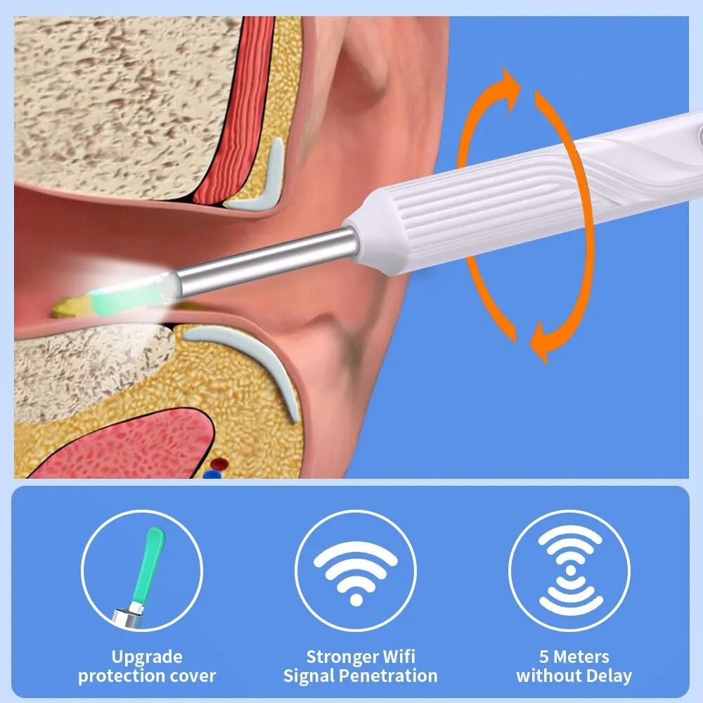 HD Wireless Ear Cleaner with Camera – Smart Otoscope Earwax Removal Tool Kit with 6 LED Lights