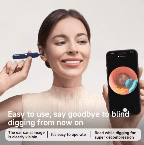 Bebird EarSight Smart Visual Earpick – Flexible ear wax removal tool with HD Camera & App Control