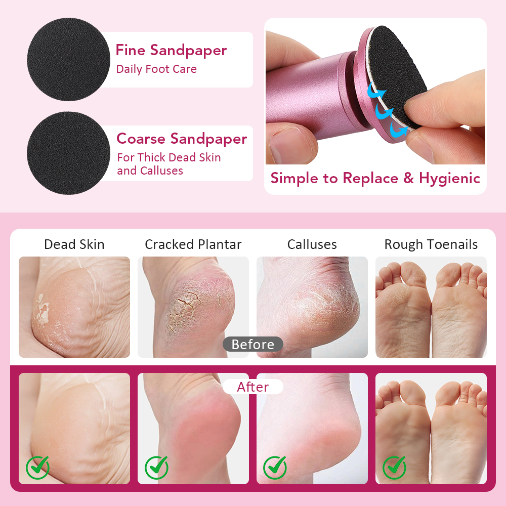 Professional Electric Foot File, Stepless Speed Control for Callus Removal