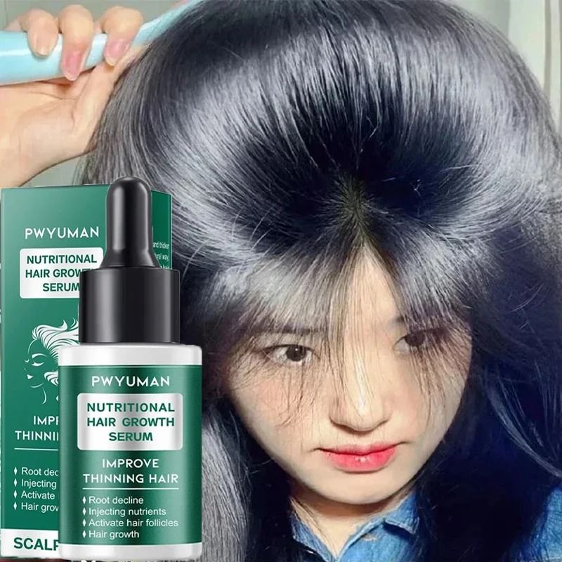 7 Days Ginger Hair Growth Serum – Fast-Acting Natural Hair Regrowth Oil for Thicker, Fuller Hair and Scalp Repair