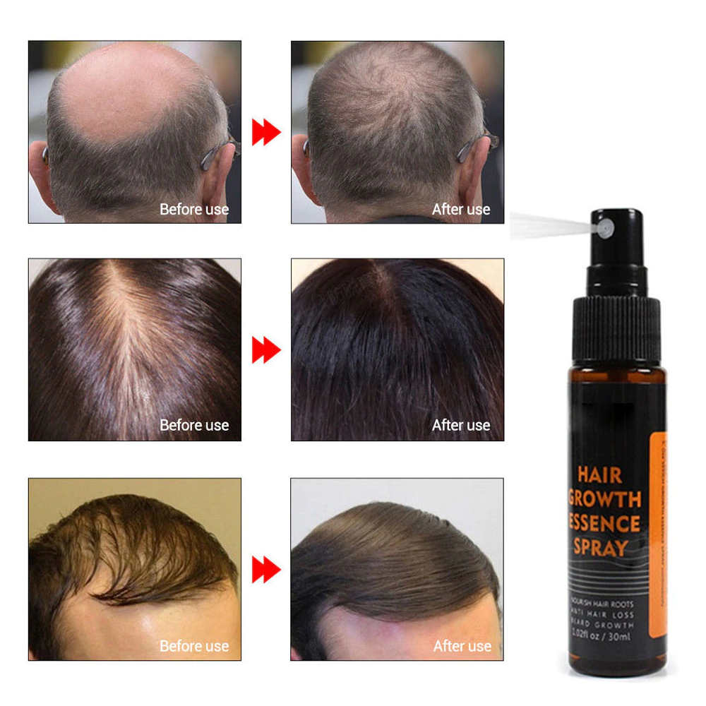 Hair Re-Growth Herbal Essence Spray
