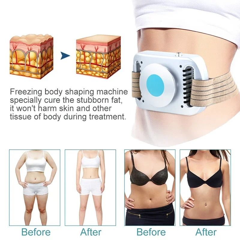 Cryolipolysis Fat Freezing Device for Belly Fat Reduction