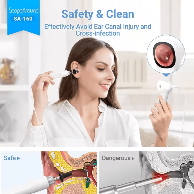 ScopeAround SA160 Digital Otoscope 720p IPS Ear Camera